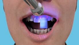 emergency dental treatment