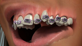 Orthodontics